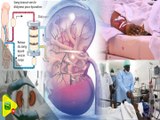 Grand Reportage - L'insuffisance rénale au Sénégal, autopsie profonde d'un secteur agonisant