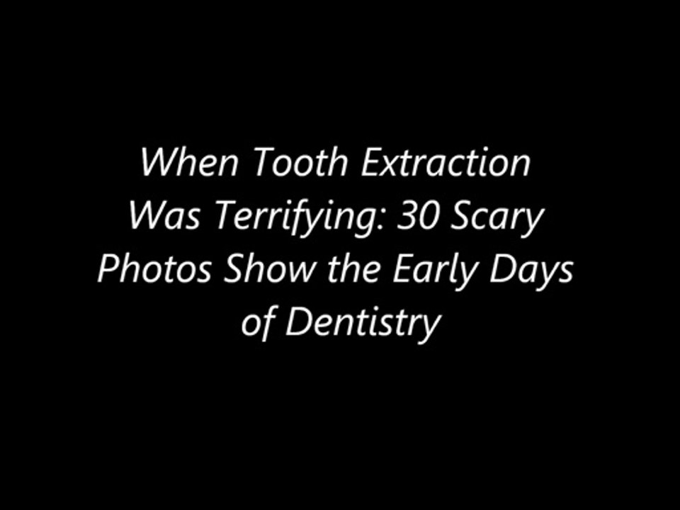 When Tooth Extraction Was Terrifying 30 Scary Photos Show the Early Days of Dentistry