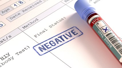 Second Patient To Ever Be Cured Of HIV Is Still Healthy