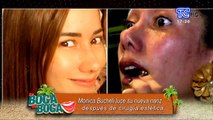 VIDEO | Mónica Bucheli luce su nueva nariz tras cirugía de reconstrucción