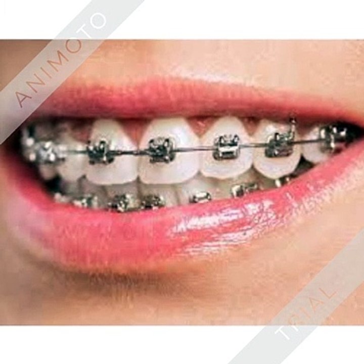 Best doctor for tooth pain treatment | Best family dental care clinic in Indore