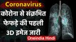 Coronavirus India: कोरोना से Infected Lungs की पहली 3D तस्वीर जारी, देखें Video | वनइंडिया हिंदी
