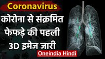 Coronavirus India: कोरोना से Infected Lungs की पहली 3D तस्वीर जारी, देखें Video | वनइंडिया हिंदी