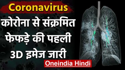 Coronavirus India: कोरोना से Infected Lungs की पहली 3D तस्वीर जारी, देखें Video | वनइंडिया हिंदी
