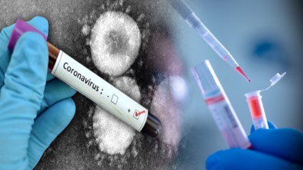 கொரோனாவுக்கு தடுப்பூசி.... அமெரிக்கா இன்று பரிசோதனை