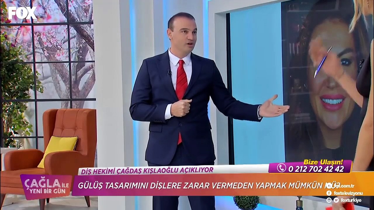 Gülüş Tasarımını Dişlere Zarar Vermeden Yapmak Mümkün Mü?