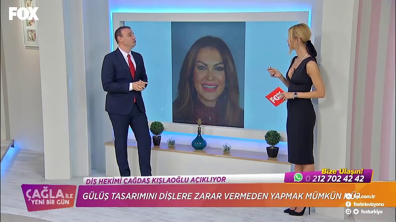 Porselen Laminaların Ömrü Ne Kadardır?