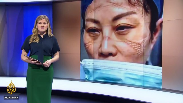 Nurses pay a heavy price as China fights coronavirus epidemic