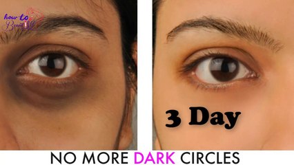 How to Remove Under Eye Dark Spots at Home in 3 Days How to Beautify
