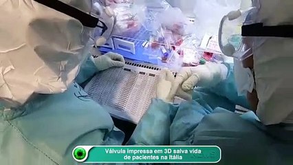 Válvula impressa em 3D salva vida de pacientes na Itália