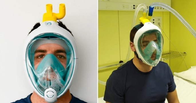 En Italie, des masques de plongée sont transformés en respirateurs pour les hôpitaux grâce à l'impression 3D