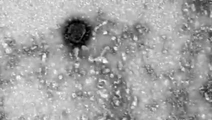 Ruslar servis etti! Dünyayı etkisi altına alan koronavirüsün mikroskop görüntüleri ortaya çıktı