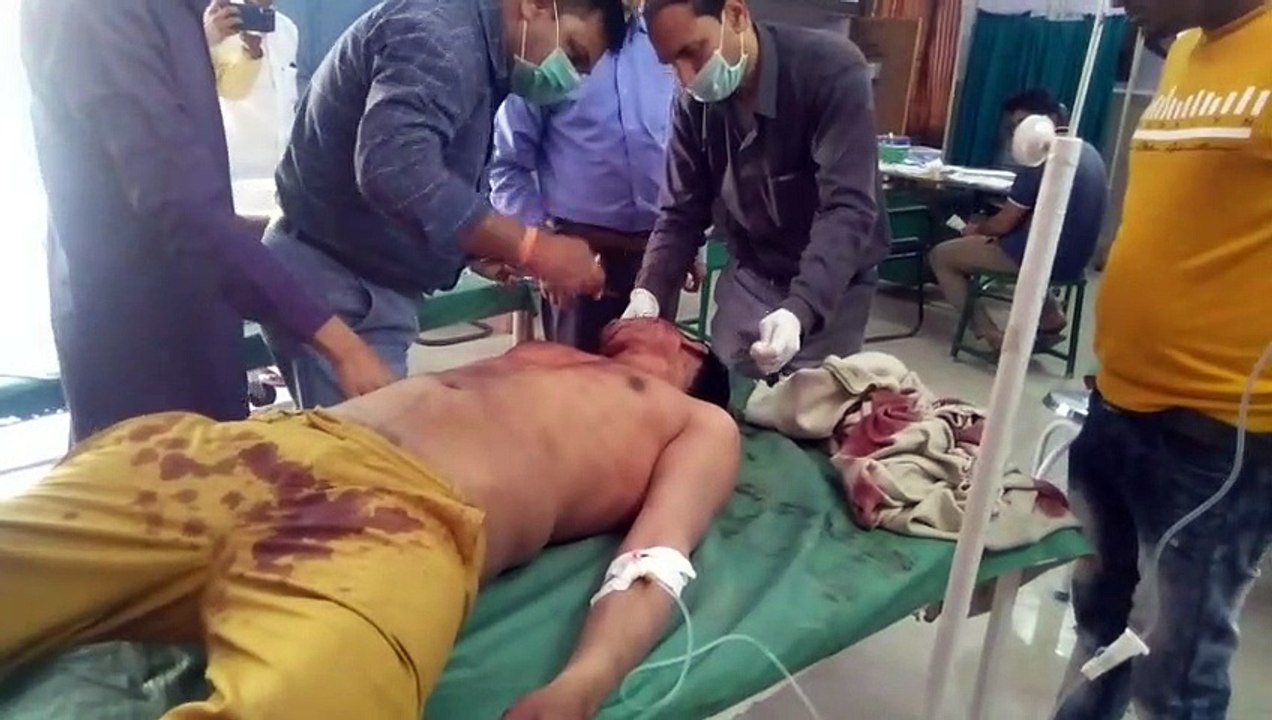 शामलीः युवक पर आधा दर्जन आरोपियों ने किया जानलेवा हमला, घायल हायर सेंटर रेफर