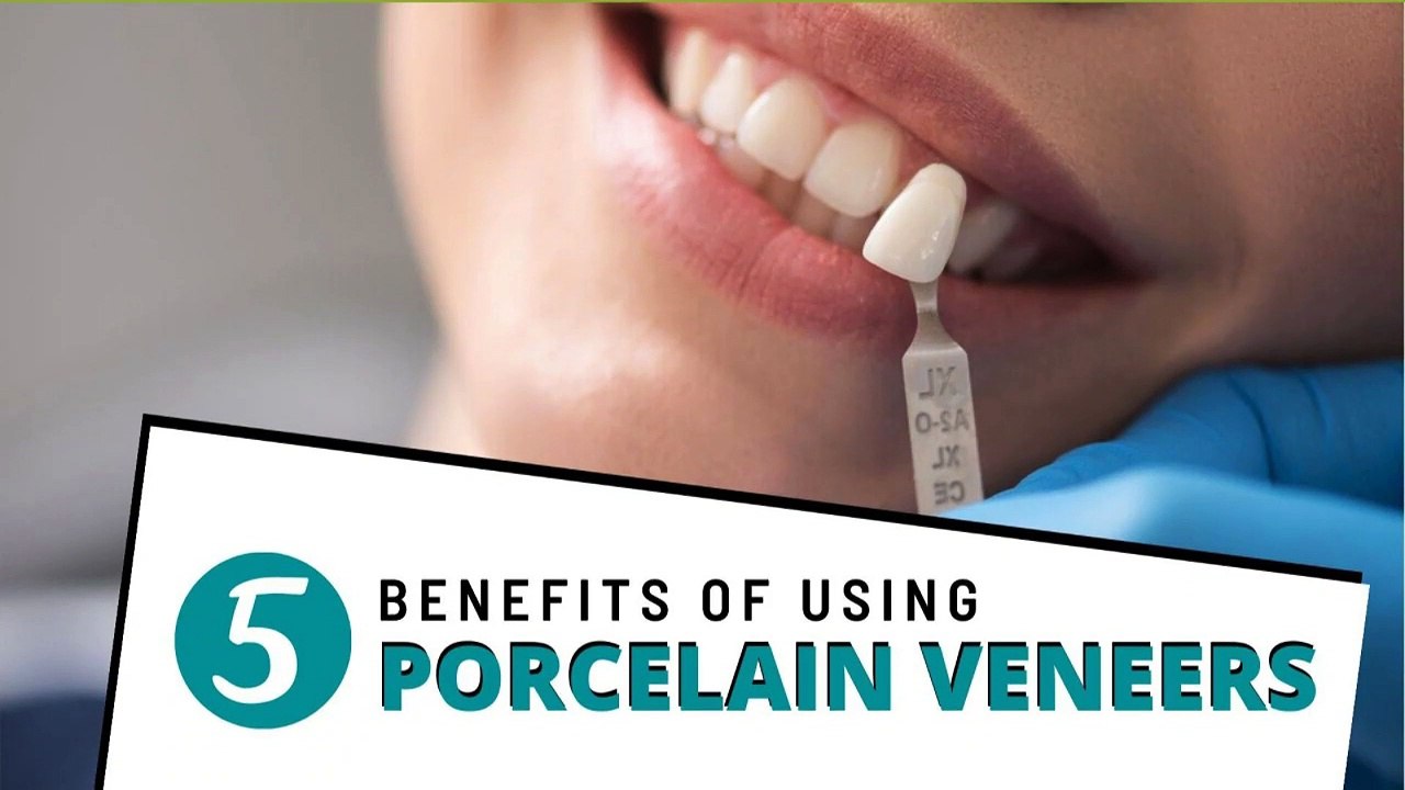 Top 5 Benefits of Using Porcelain Veneers