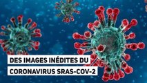 Des images inédites du coronavirus Sras-CoV-2