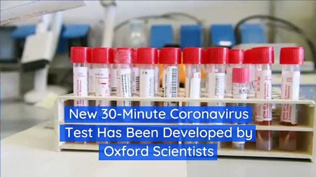 New 30-Minute Coronavirus Test Has Been Developed by Oxford Scientists