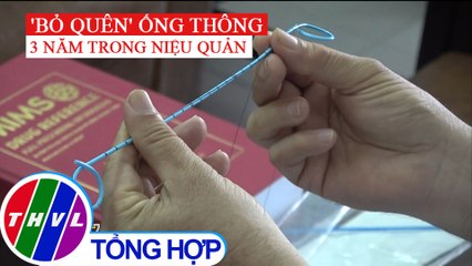 Phẫu thuật lấy ống thông niệu quản bị bỏ quên hơn 3 năm trong cơ thể