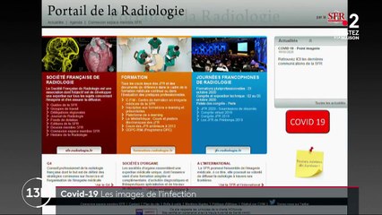 Coronavirus : les poumons gravement atteints
