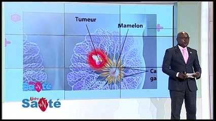 "Notre Santé" consacré au  Centre National d'oncologie Médicale et de Radiothérapie Alassane Ouattara