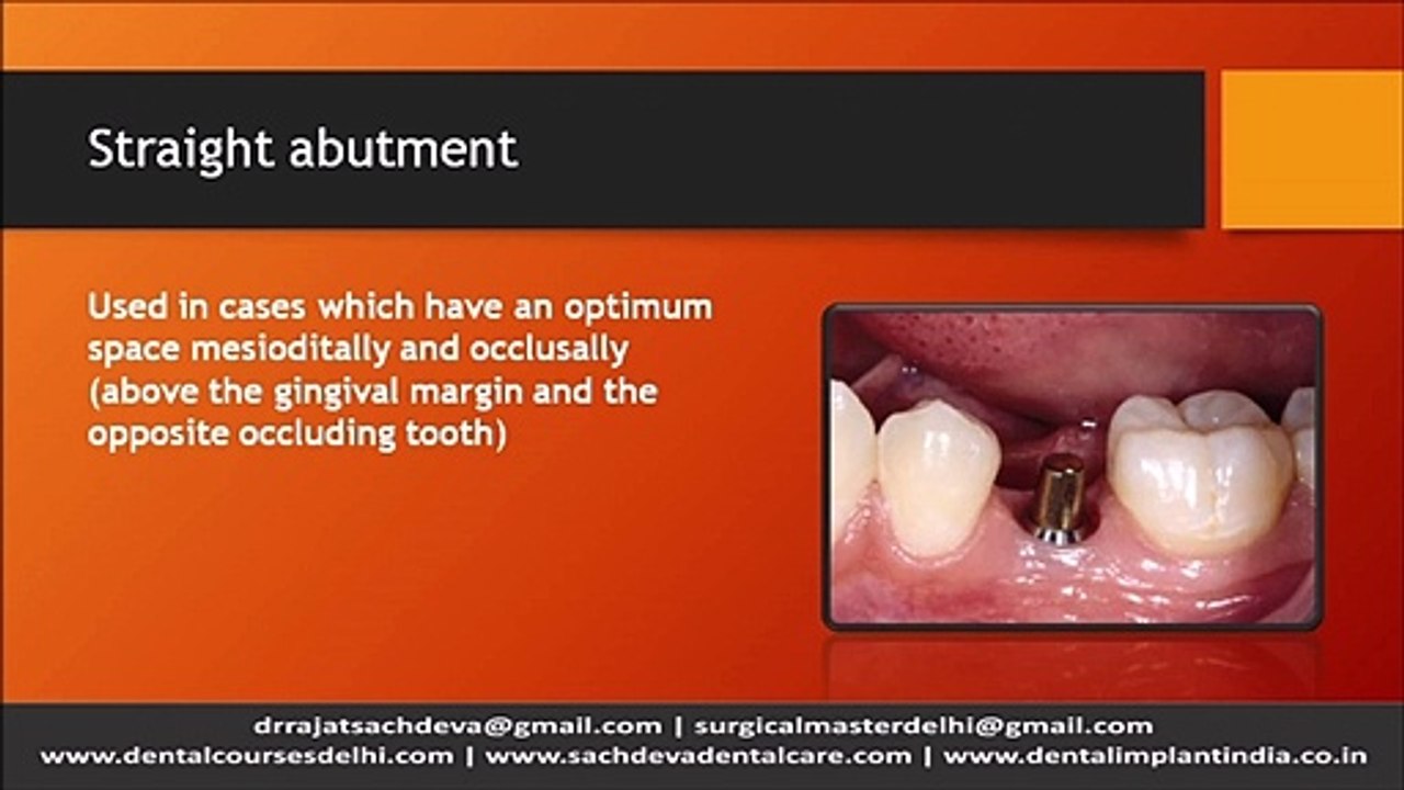 Tooth Implant In Delhi _ Best Implantologists in Delhi _ Dental Implants in Delhi