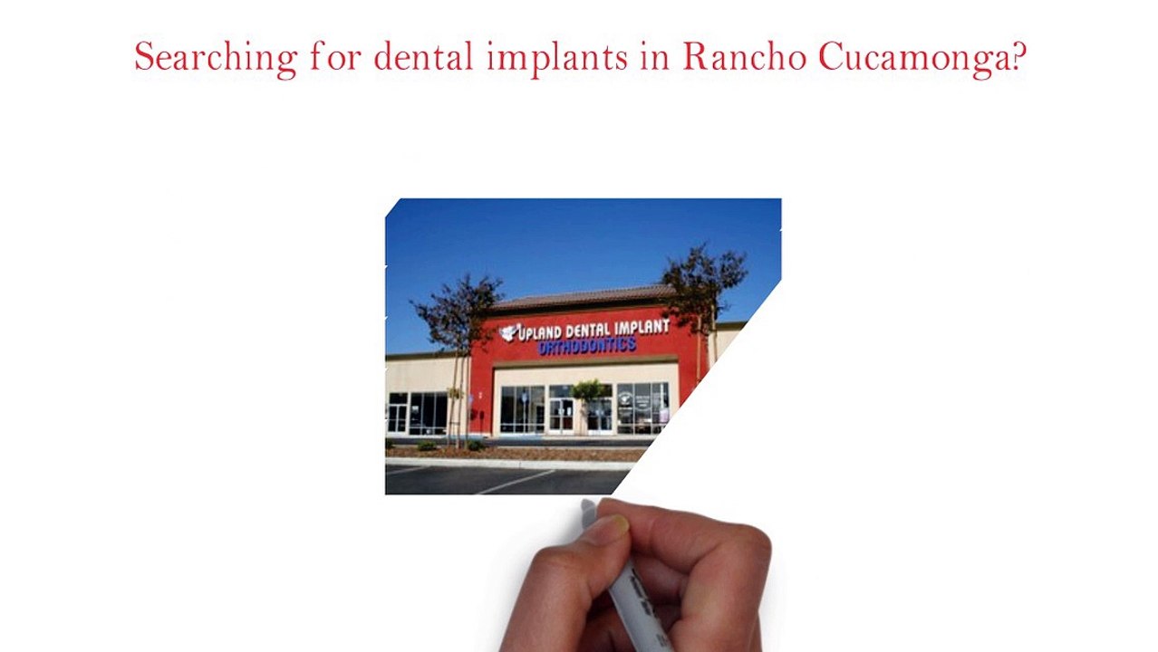Dental Implant In Rancho Cucamonga, CA