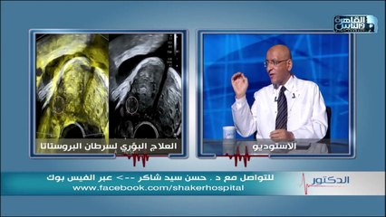 الدكتور | مشاكل البروستاتا وطرق علاجها مع دكتور حسن سيد شاكر