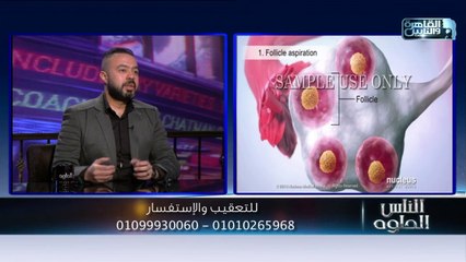 الناس الحلوة | الحلقة الكاملة 21 مارس 2020 مع دكتور أيمن رشوان