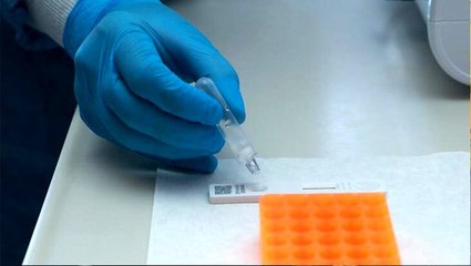 Son Dakika: Türkiye'de 15 dakikada sonuç veren koronavirüs testi uygulanmaya başladı