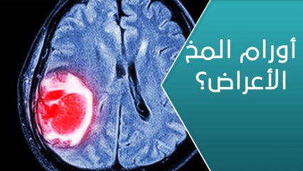هل تؤثر أورام المخ على صحة الإنسان؟ - العيادة