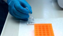 Son Dakika: Türkiye'de bugüne kadar toplam 20 bin 345 koronavirüs testi yapıldı