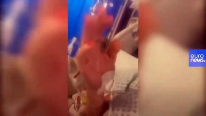 39 yaşındaki kadın corona virüs yoğun bakımından bir video paylaştı ve uyarıyor: "Bana bulaşmaz demeyin."  Lütfen arkadaşlar şu vurdumduymaz tavırlara son verin artık.   Kaynak: euronews