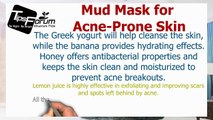 How To Get Rid Of Acne Prone Skin - Acne Prone Skin Mud Mask At Home
