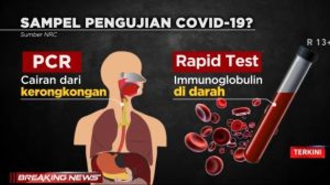 DPR Bukan Prioritas, Tim Medis & ODP Segera Jalani Rapid Test