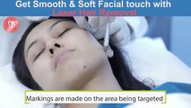 Smooth, Soft and Hair-free Skin like never before - Laser Hair Reduction _ Watch how Laser is done!