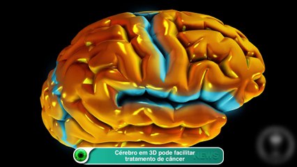 Cérebro em 3D pode facilitar tratamento de câncer