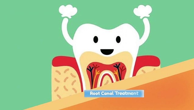 Root Canal Treatment | My Dental Company