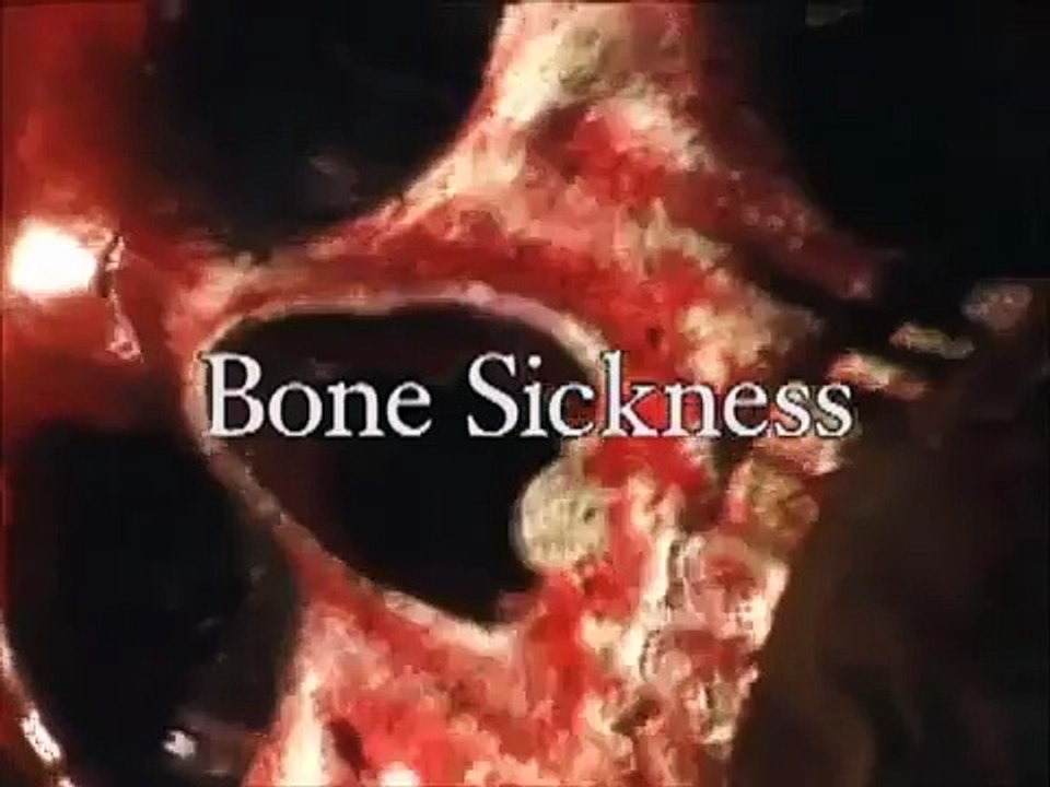 Bone Sickness Trailer