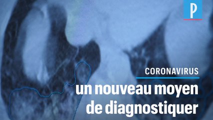 Un scanner pour détecter le coronavirus chez des personnes aux «tests négatifs»