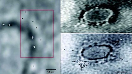 Indian scientists reveal first microscopic image of novel coronavirus