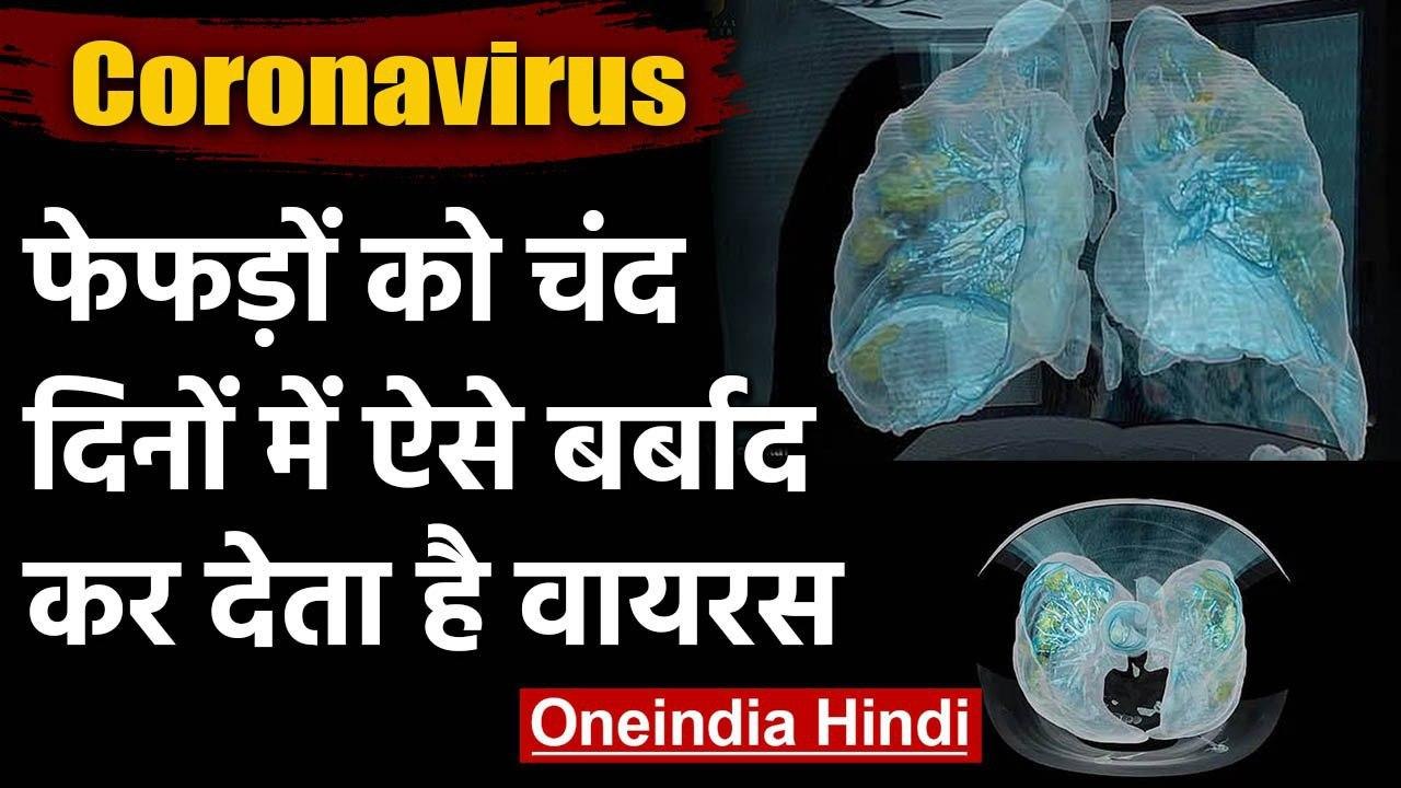 Coronavirus: Lungs को कैसे बर्बाद कर देता है Co...