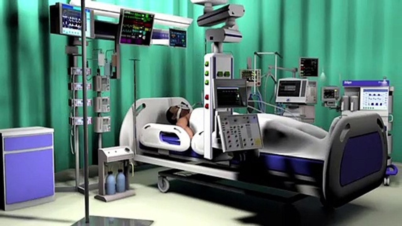 Videografik: So funktioniert ein Beatmungsgerät