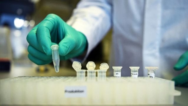 ABD'den umutlandıran iddia: HIV ve meme kanseri ilacıyla 2 koronavirüs hastası iyileştirildi