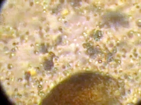 Spermatozoïdes autour de l'ovule