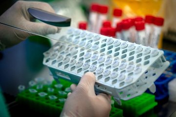 Son Dakika: Dünya genelinde yeni tip koronavirüs vaka sayısı 700 bini geçti