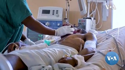 Coronavirus isn't the deadliest disease in Nigeria, it is Lassa Fever