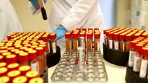 İngiltere'de 5 dakikada sonuç veren koronavirüs test cihazı geliştirildi