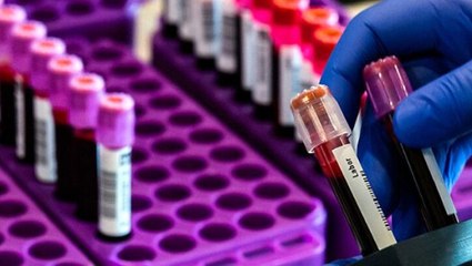 İngiliz araştırmacılar üç tip koronavirüsü incelediler: Enfeksiyonlar ilkbaharda durma noktasına geliyor