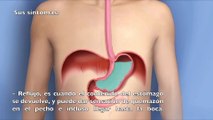 Daniel Esgardo Rangel Barón te habla sobre la gastritis