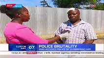 Nakuru Man Clobbered by Police Opens Up