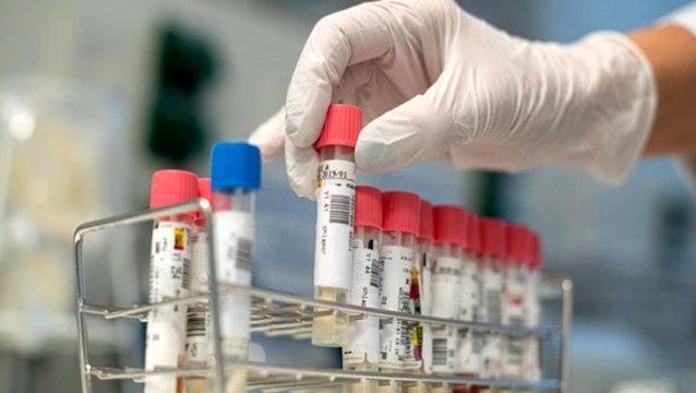 Bilim insanları şokta! 49 gün boyunca vücutta kalan mutasyona uğramış koronavirüs tespit edildi